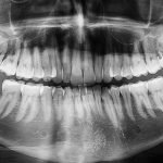 the power of a cone beam image