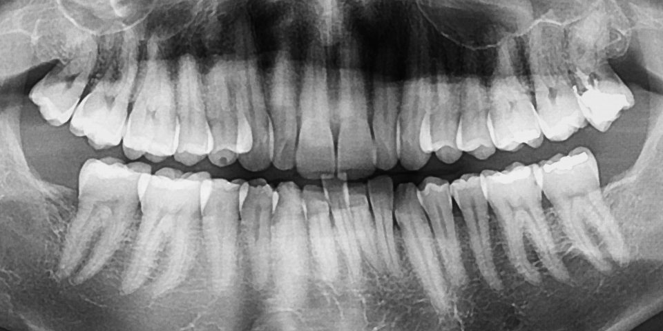 the power of a cone beam image
