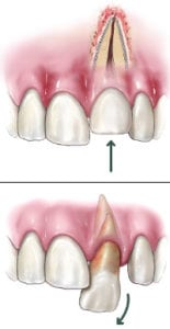 tooth injury charlotte nc