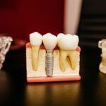 when is a dental implant needed