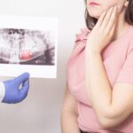 can a tooth infection be cured with antibiotics