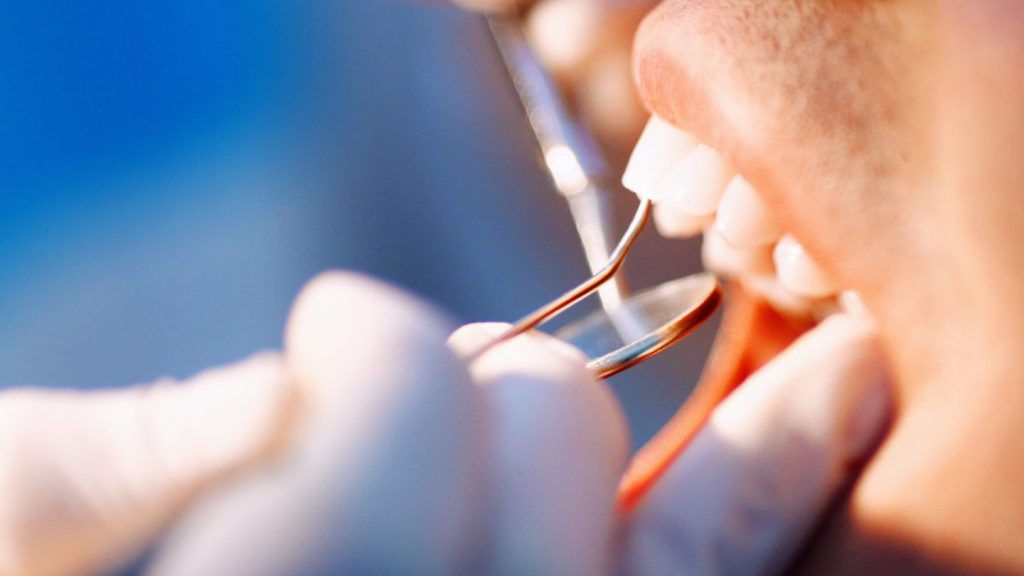 can a cracked tooth heal on its own