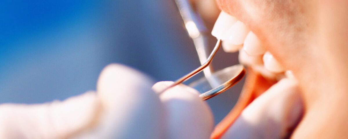 can a cracked tooth heal on its own