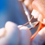 can a cracked tooth heal on its own