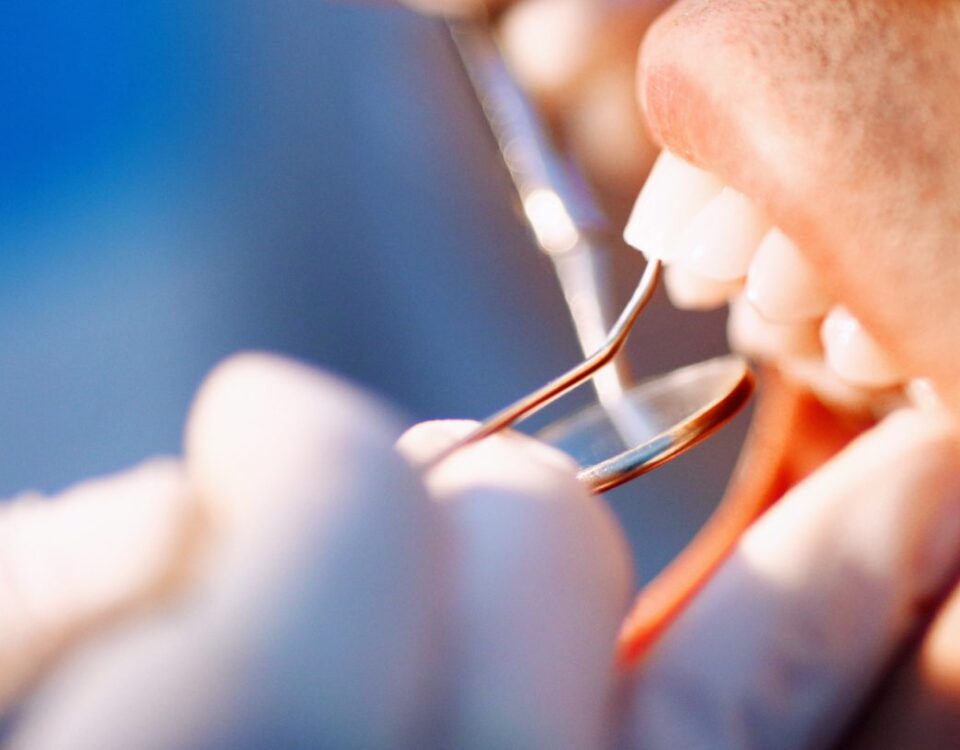 can a cracked tooth heal on its own