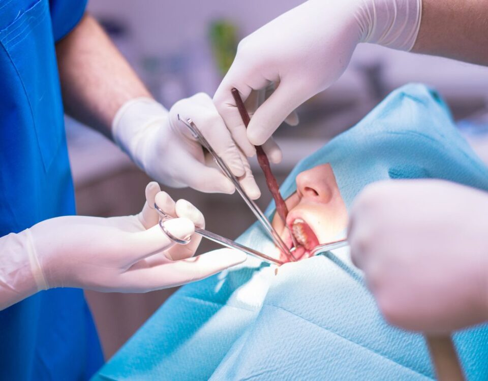 endodontic surgery vs. root canal
