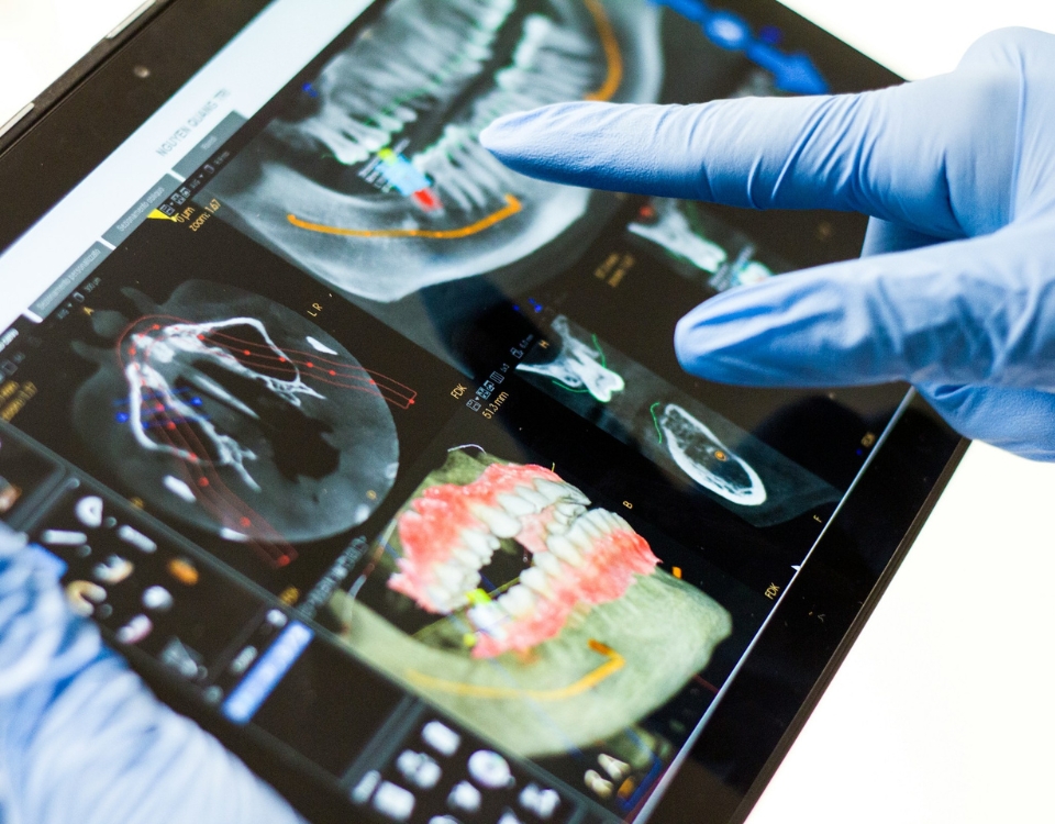 root canal or extraction